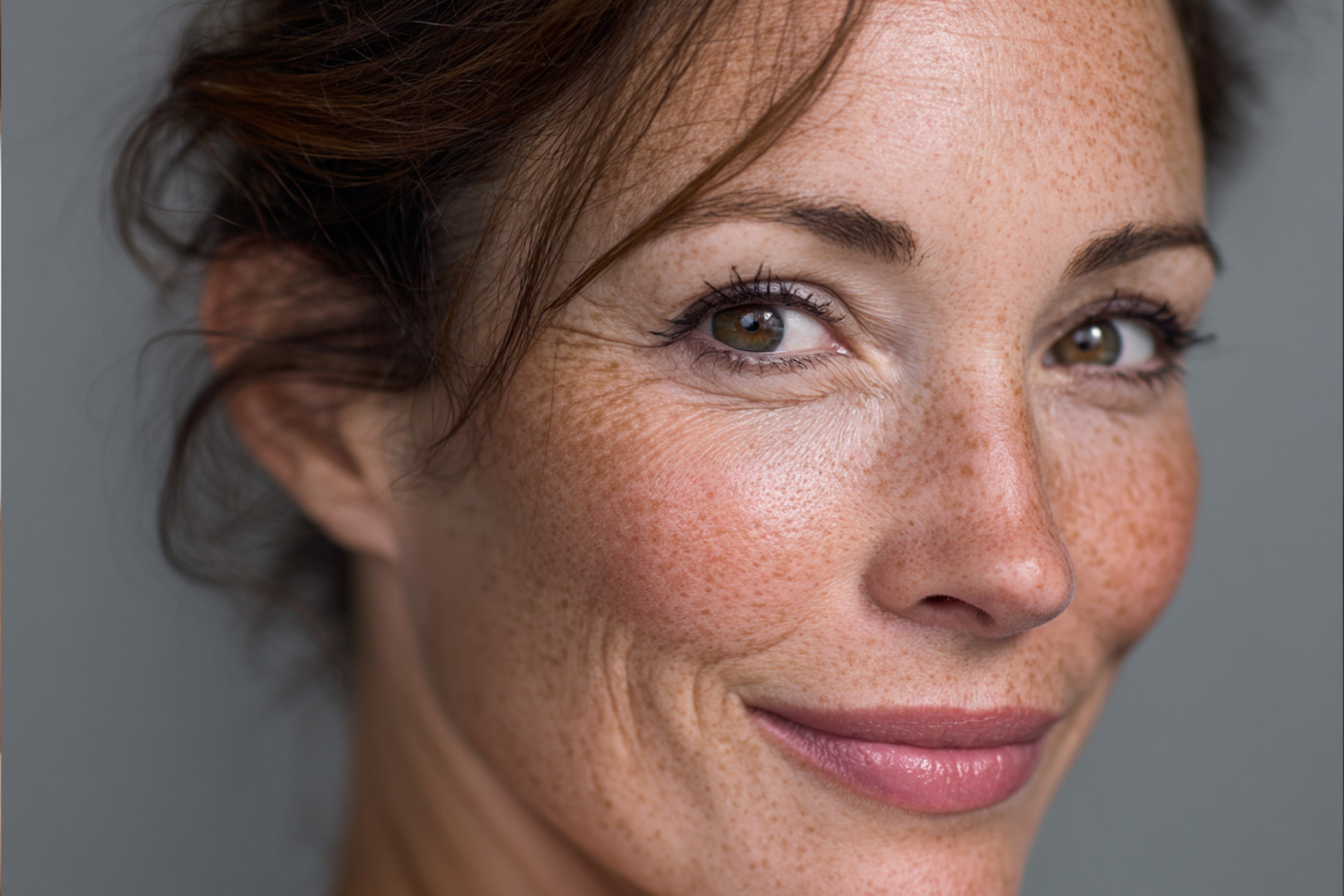 Pergamenthaut – wenn die Haut dünner wird